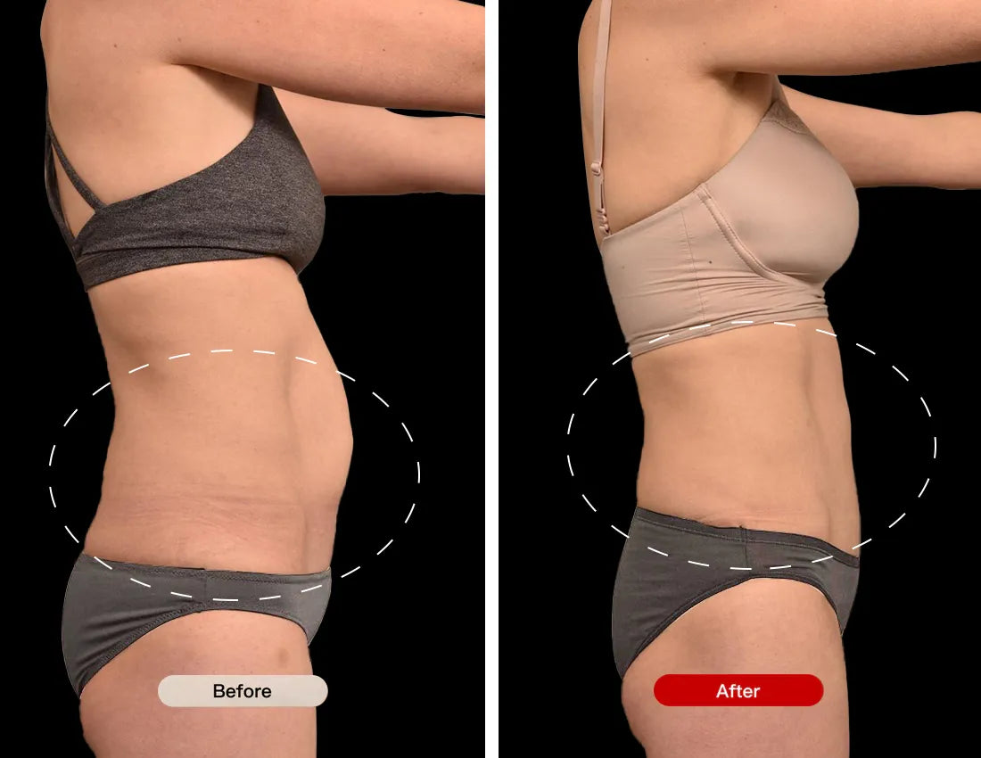 Before and After Using the Red Light Therapy Belt