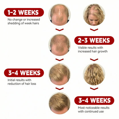 RICIAL FOLIRAY Red Light Therapy Cap