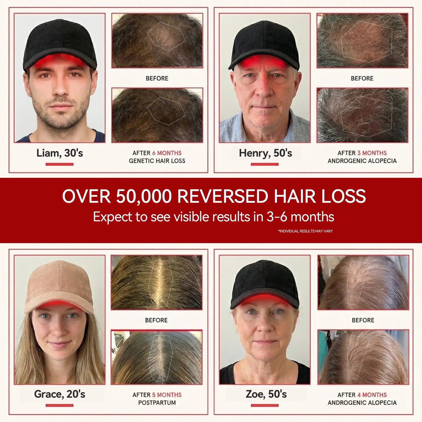 RICIAL FOLIRAY Red Light Therapy Cap