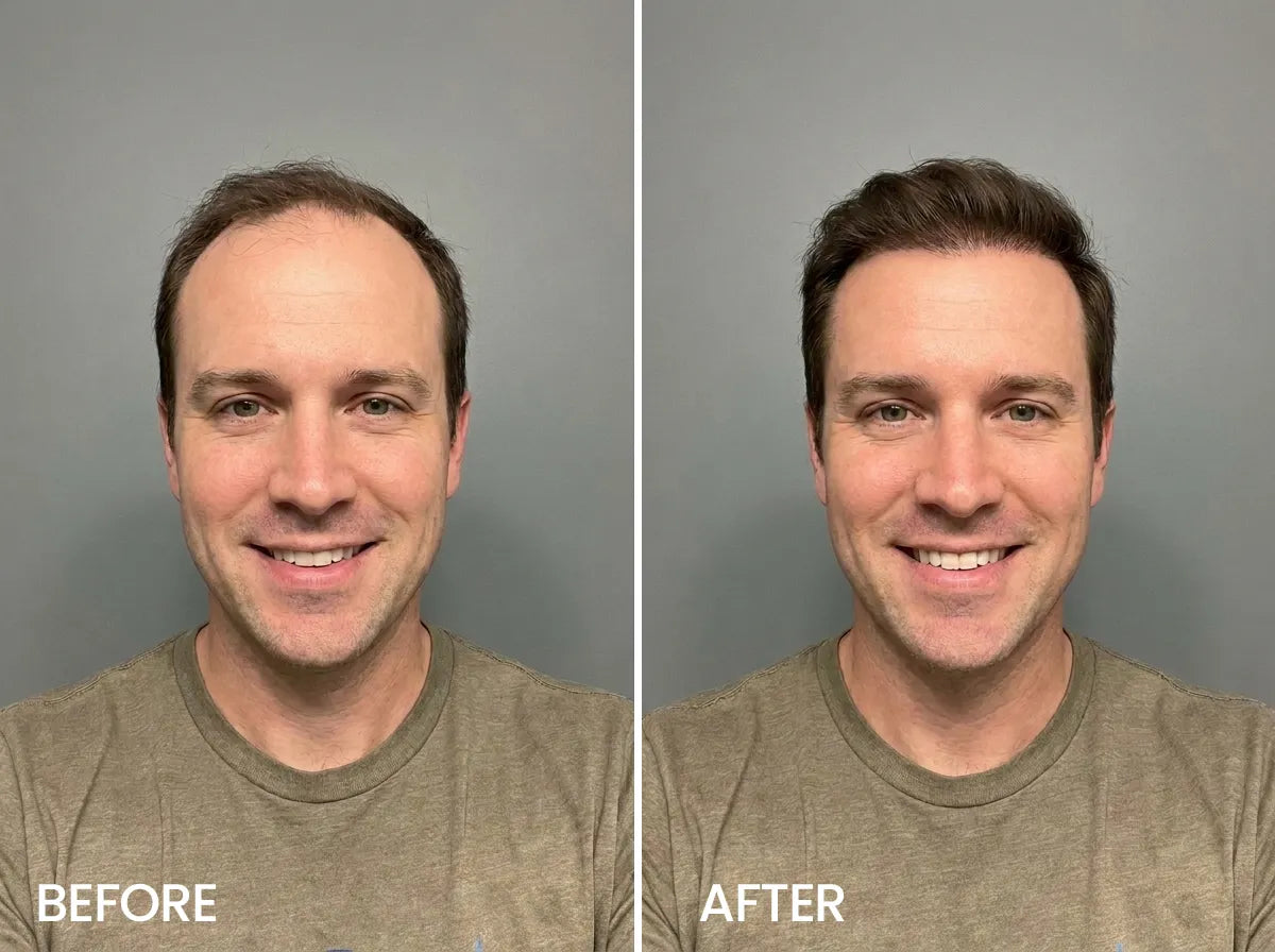 Daniel Brooks, 32 before and after