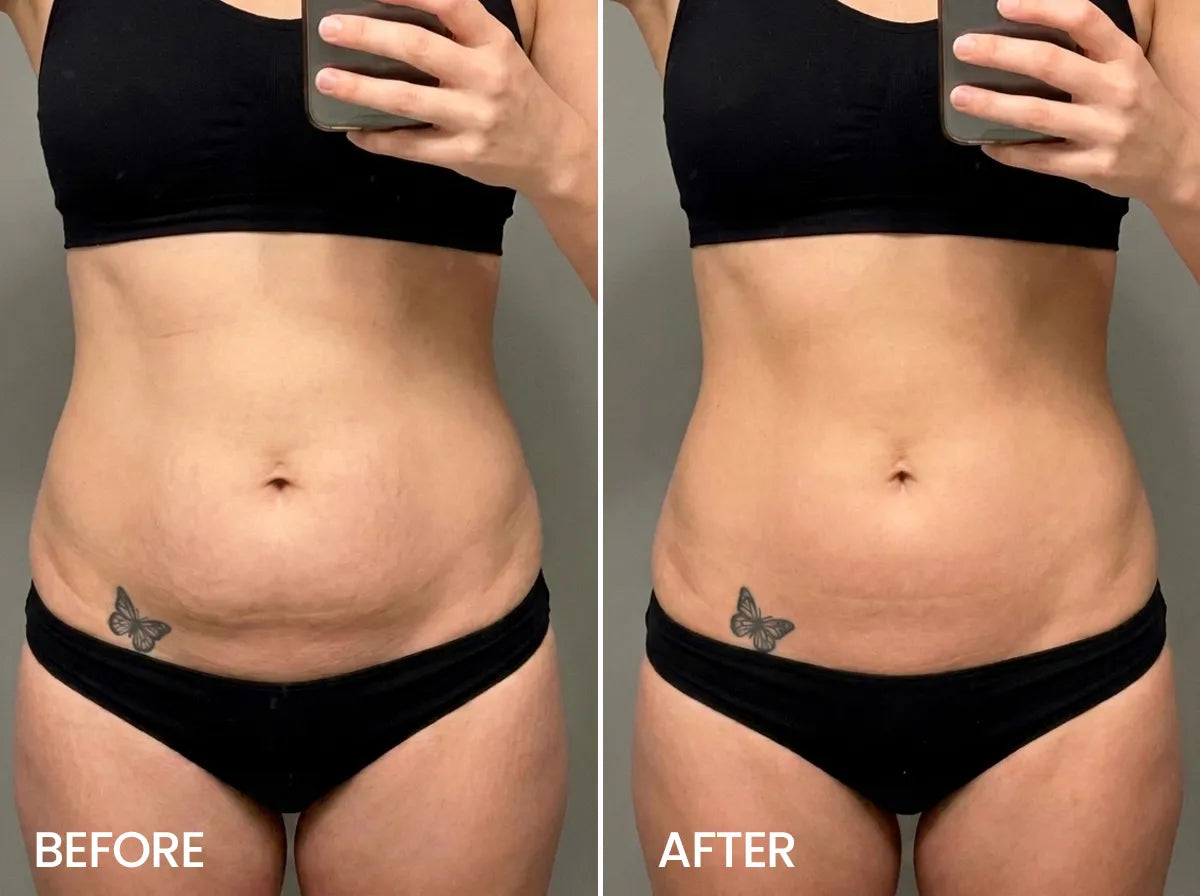 Jessica Miller, 38 before and after