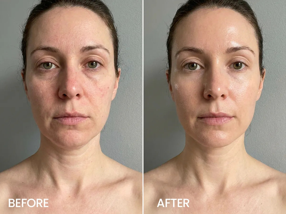 Emily Carter, 34 before and after