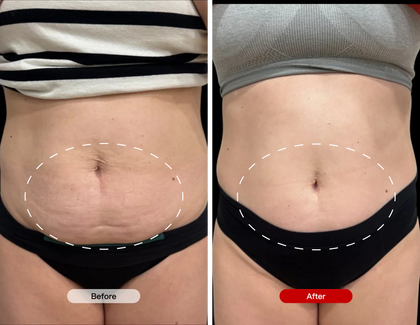 After 4 weeks